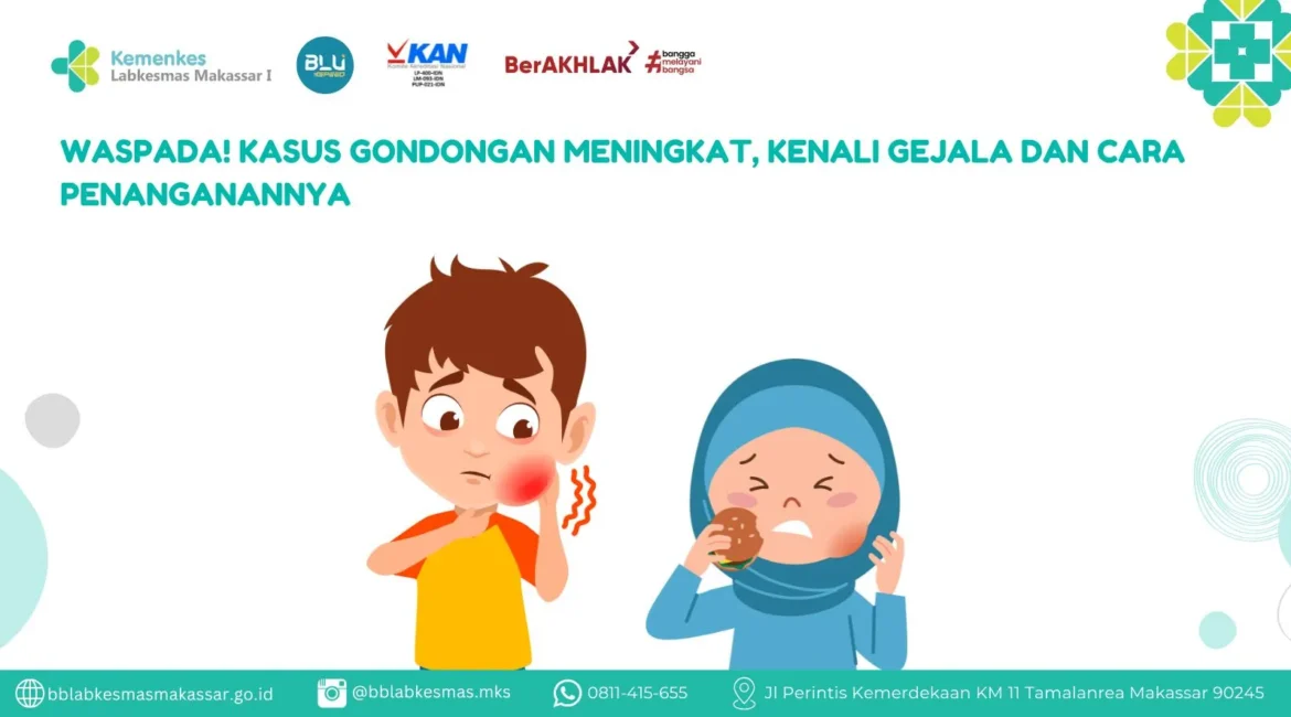 ilustrasi penyakit gondongan (mumps)