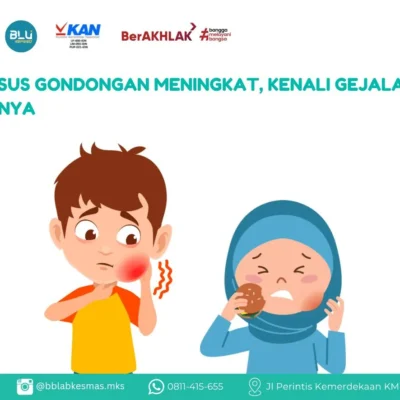 ilustrasi penyakit gondongan (mumps)